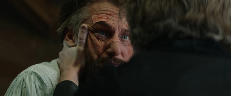 Nothing a bit of blood-letting can't cure.