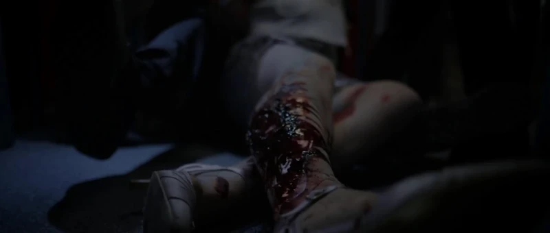 They didn't even have to mangle her leg. They didn't even have to mangle her leg.