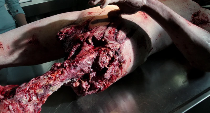 Nobody seems to care that a human can't bite a quadriceps off. Nobody seems to care that a human can't bite a quadriceps off.